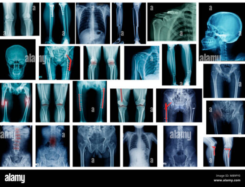 X-ray Image Acquisition