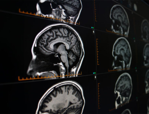 Diagnosing Headaches Through Radiology