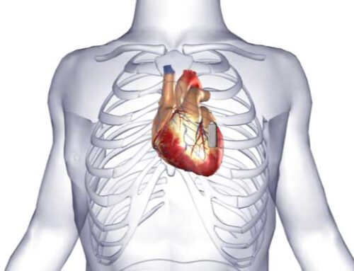 All about Cardiac Loop 