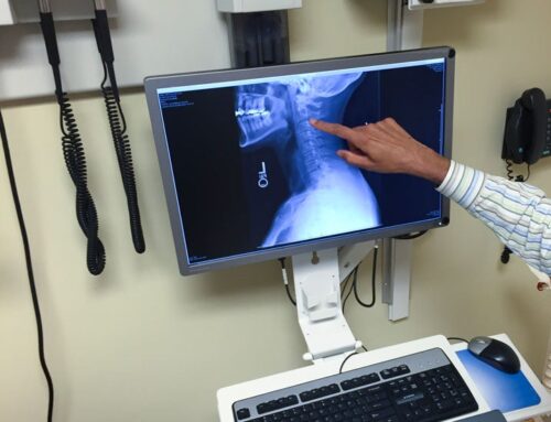 What is Neck X-ray?