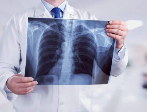 Things to Know About X-ray